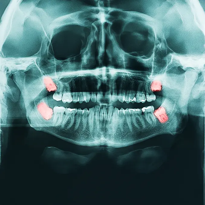 Maxillofacial Surgeon in Dubai for Complex Procedures