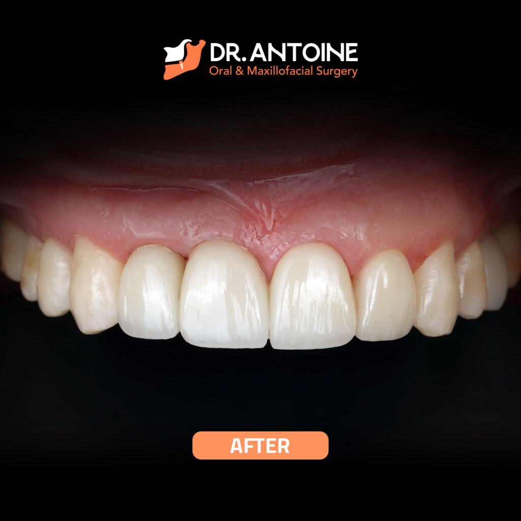 Dental Health Care