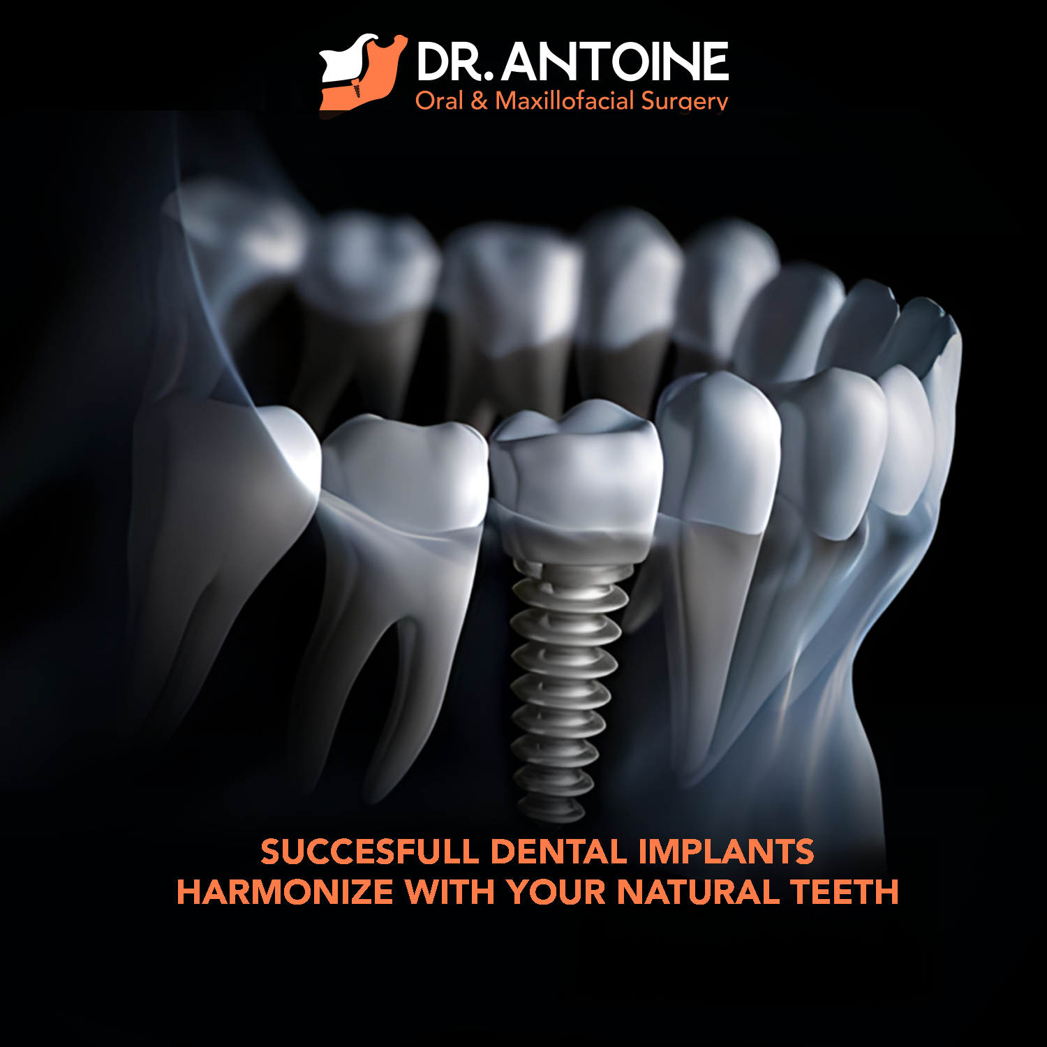 Surgery for Dental Implants