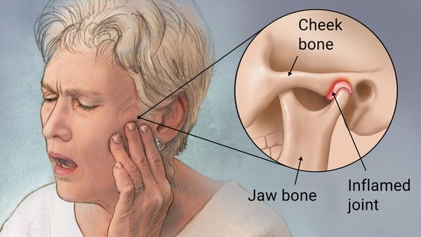 Chronic Jaw discomfort