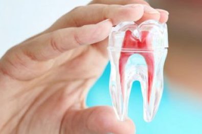 root canal specialist dubai (6)